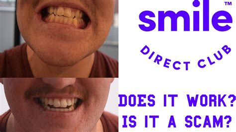 does smile direct club really work.